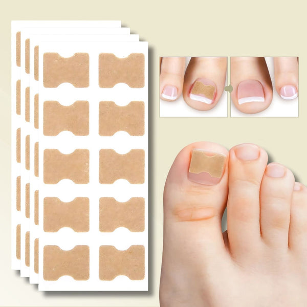 Nail Care Patches – Effective Relief for Ingrown Toenails - Image 1