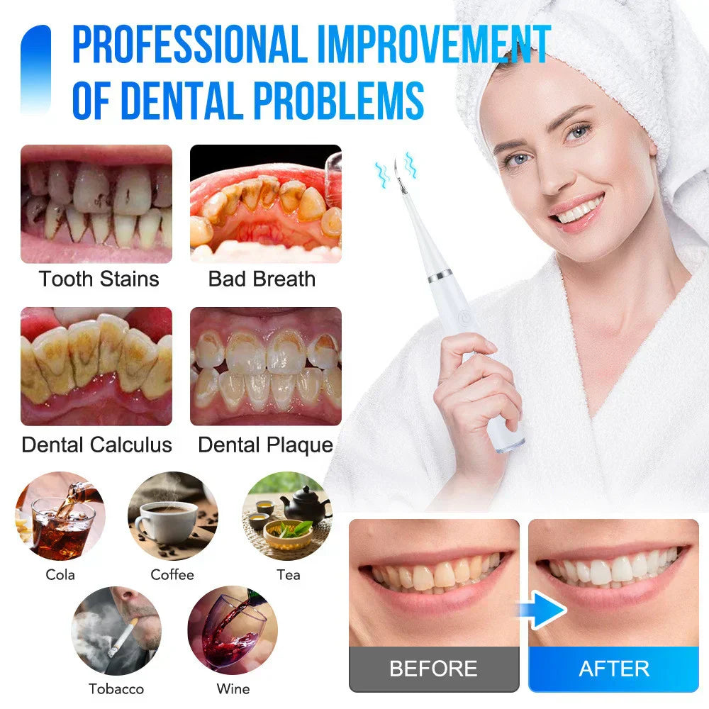 Electric Teeth Cleaner – Professional Dental Care at Home - Image 2