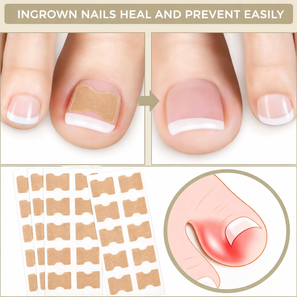 Nail Care Patches – Effective Relief for Ingrown Toenails